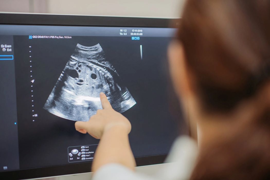 A doctor points to an expectant mother's sonogram.