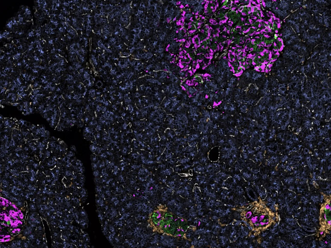 This is a microscopic view of islets of insulin-producing beta cells from a human pancreas, shown using immunofluorescent staining. The islets are green. (Courtesy of Clive Wasserfall and Denise Drotar.)