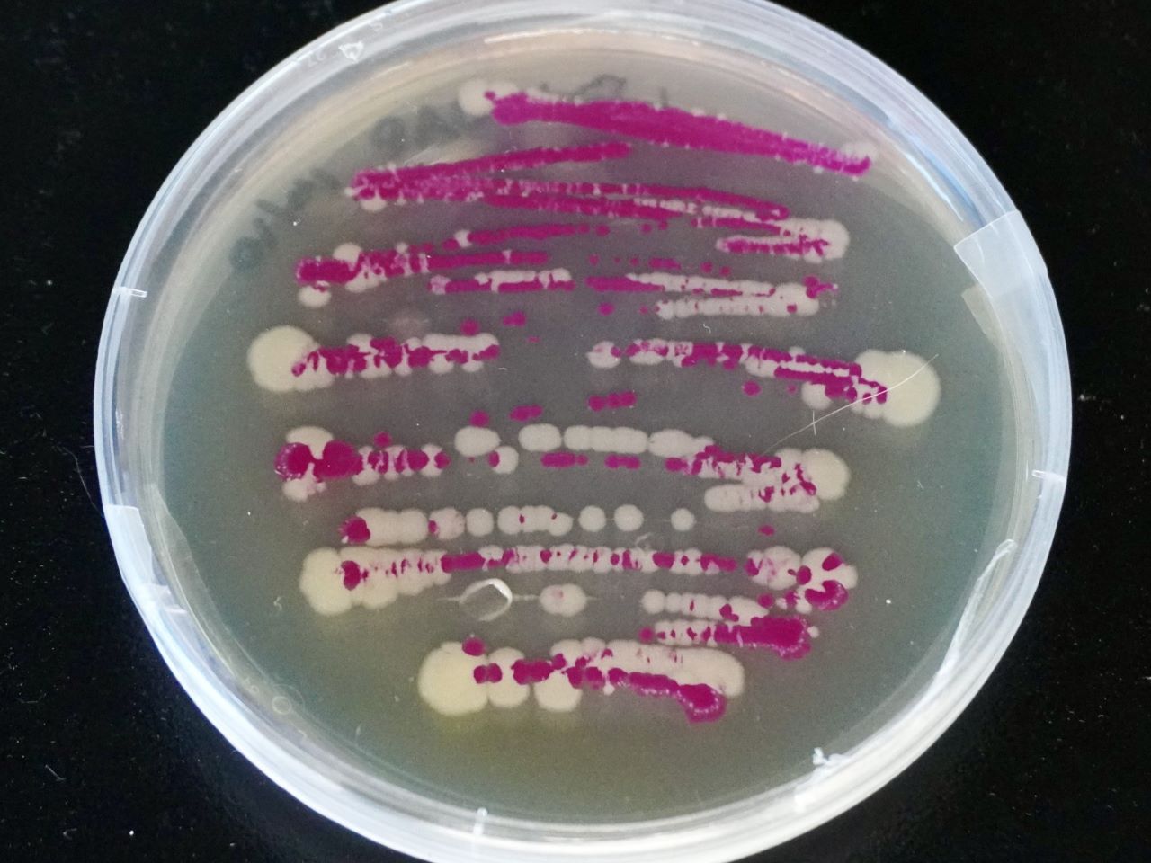 A petri dish growing both white and purple bacteria