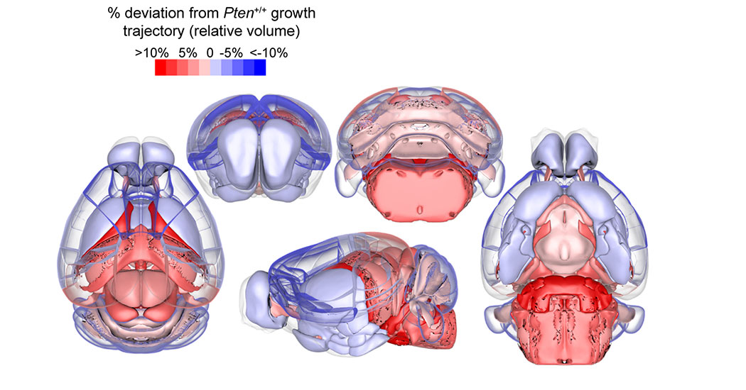 MRI images of a brain