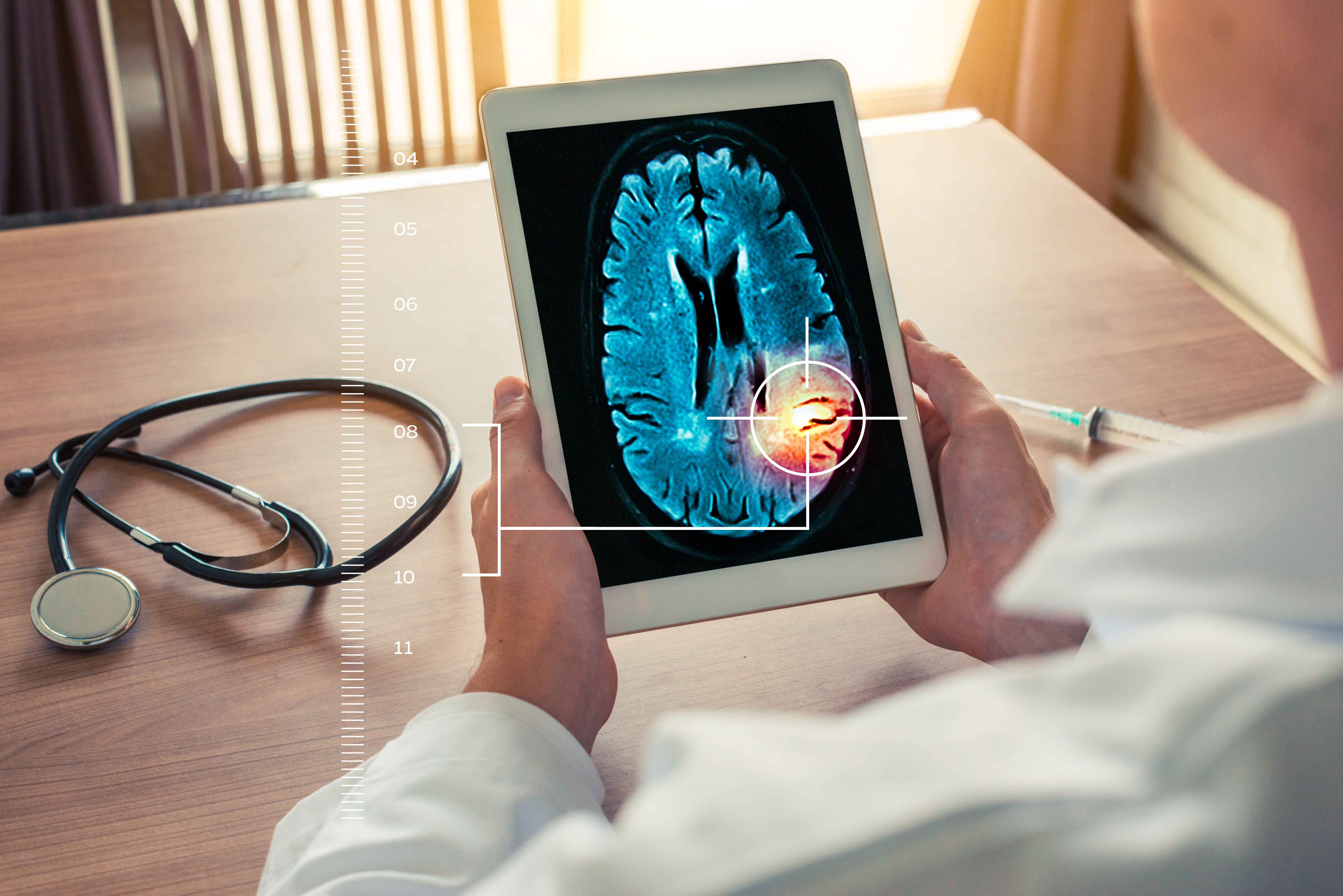 A doctor holds a tablet with a brain scan on it.