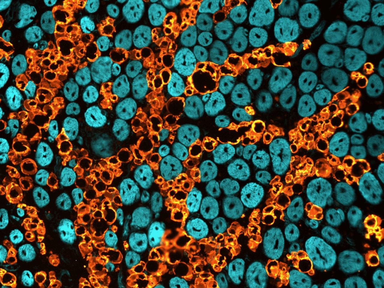 A micrograph of blue muscle fibers interwoven with orange fat cells
