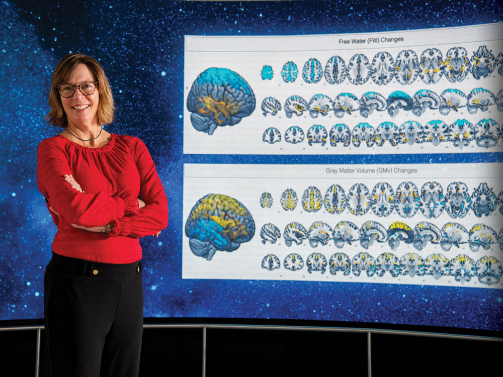 Rachael Seidler posed in front of brain scans.