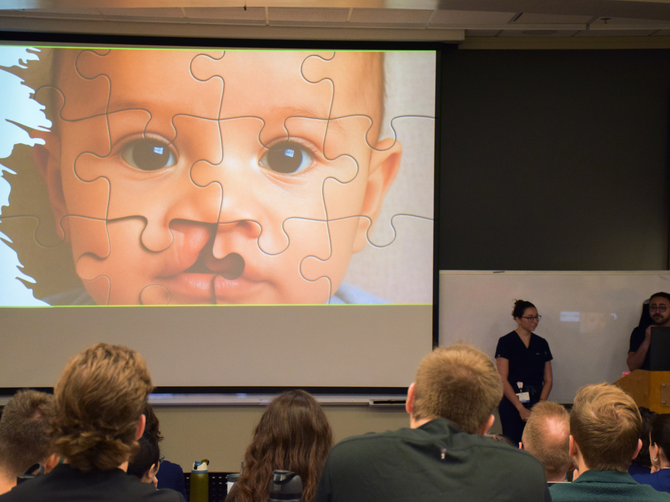 Jonathan Sorsok, D.M.D., uses a jigsaw puzzle analogy to explain how a cleft lip or palate occurs